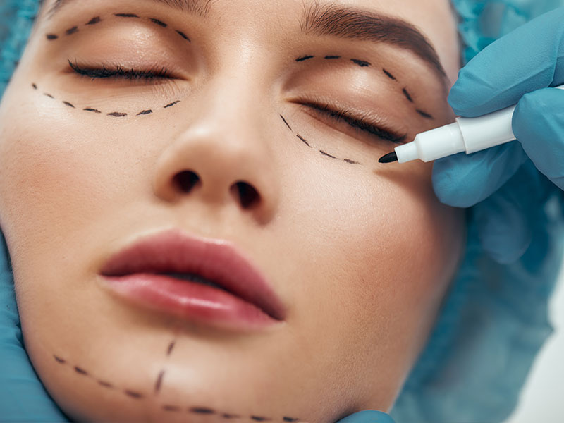 Facial Surgeries in Siliguri