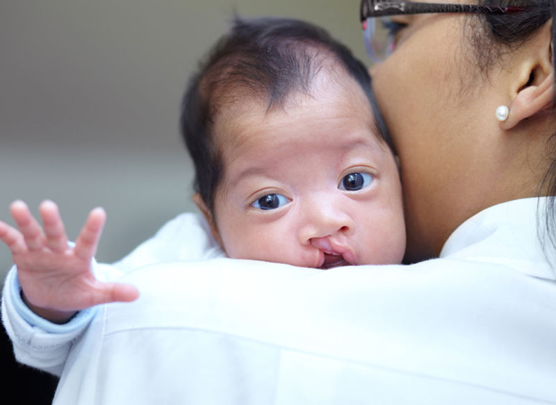 Cleft Lip and Palate Surgery