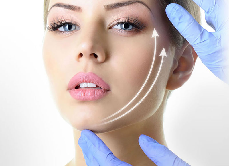 Facelift Surgery