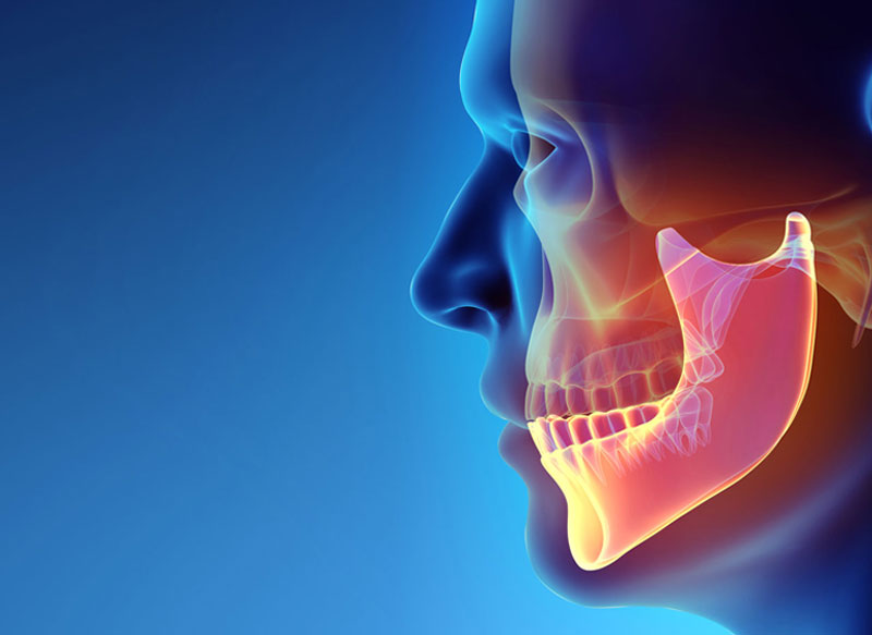 Faciomaxillary Trauma