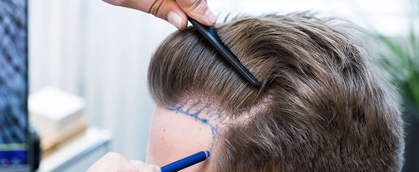 Common cases for chin augmentation include