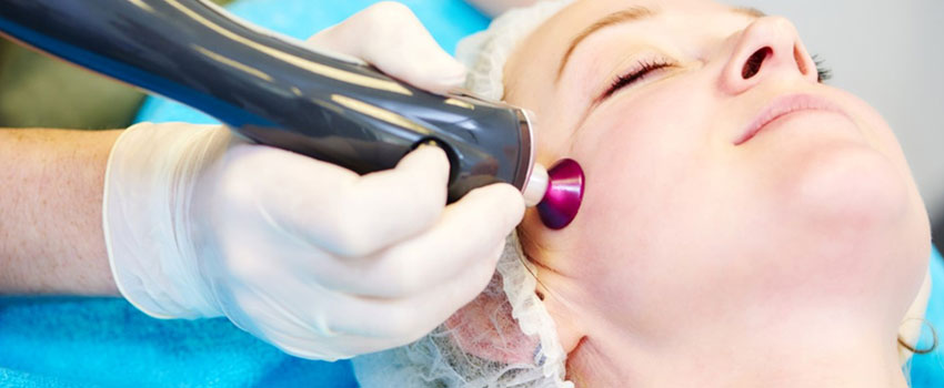 Acne scar treatment techniques